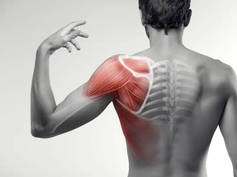Shoulder Pain Treatment Near Me in Wyoming, MI. Chiropractor for Shoulder Pain Relief.