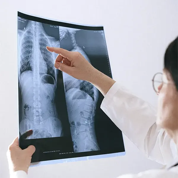 Scoliosis Treatment Near Me in Wyoming, MI. Chiropractic Care For Scoliosis Pain Relief.